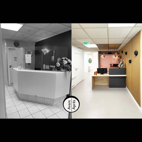 Avant Après Accueil